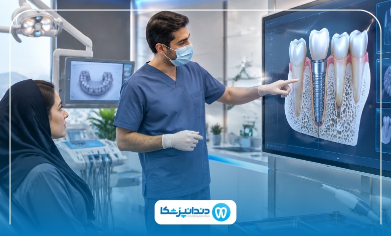 چه افرادی نمی‌توانند ایمپلنت انجام دهند؟