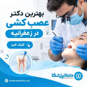بهترین دکتر عصب کشی در زعفرانیه