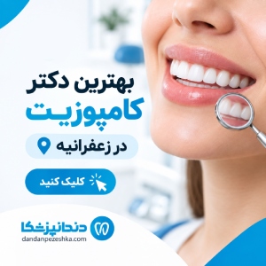 بهترین دکتر کامپوزیت در زعفرانیه
