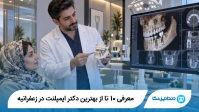 بهترین دکتر ایمپلنت در زعفرانیه