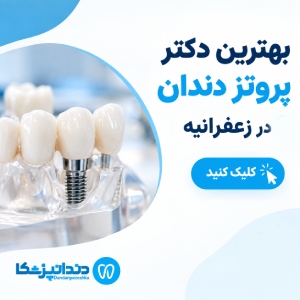 بهترین دکتر پروتز دندان در زعفرانیه