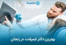 بهترین دکتر ایمپلنت در زنجان