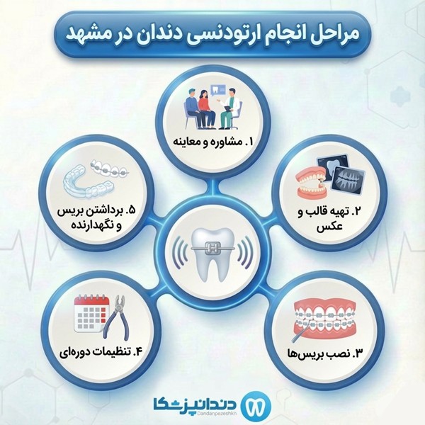 مراحل انجام ارتودنسی دندان در مشهد