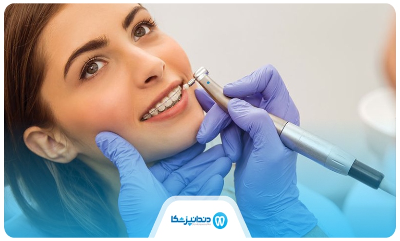 توصیه های مراقبتی بهترین دکتر ارتودنسی در سعادت آباد