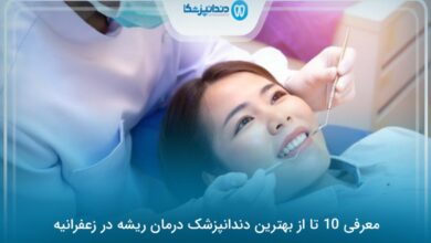 بهترین دندانپزشک درمان ریشه در زعفرانیه