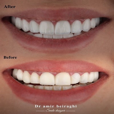 دکتر امیر بیرقی