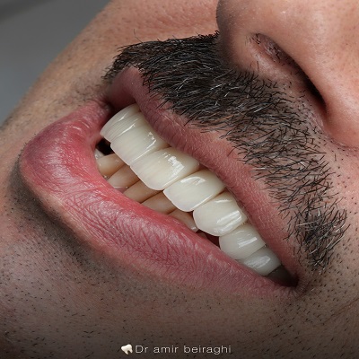 دکتر امیر بیرقی