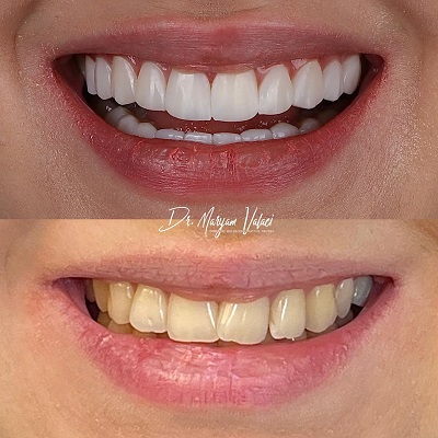 دکتر مریم ولایی