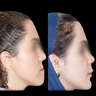 دکتر هادی درویش پورکاخکی