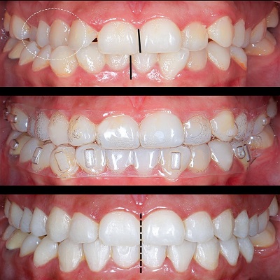 دکتر هادی درویش پورکاخکی