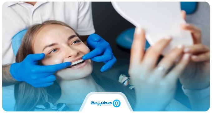 مزایای انجام لمینت دندان