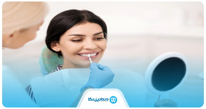 هزینه انجام لمینت چقدر است؟