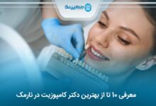 بهترین دکتر کامپوزیت در نارمک