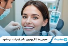بهترین دکتر ایمپلنت در مشهد