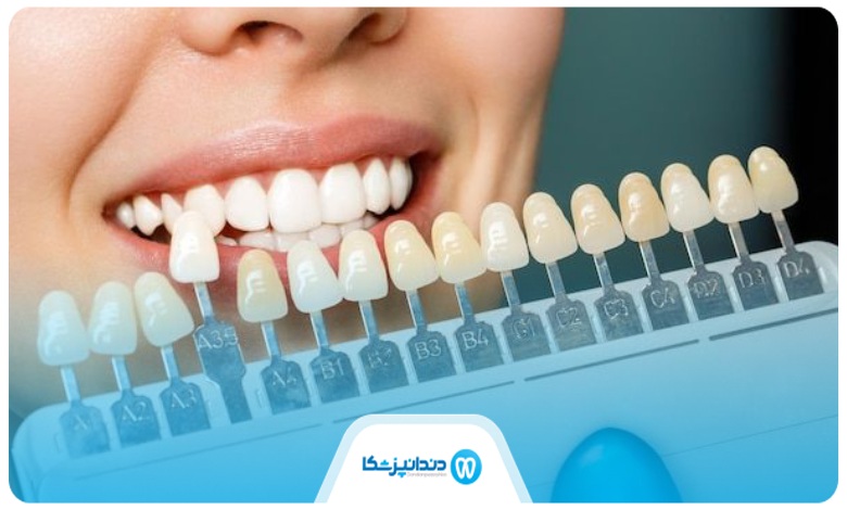 انواع روش های ایمپلنت دندان
