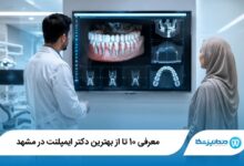 بهترین دکتر ایمپلنت در مشهد