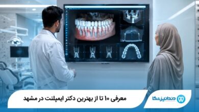 بهترین دکتر ایمپلنت در مشهد