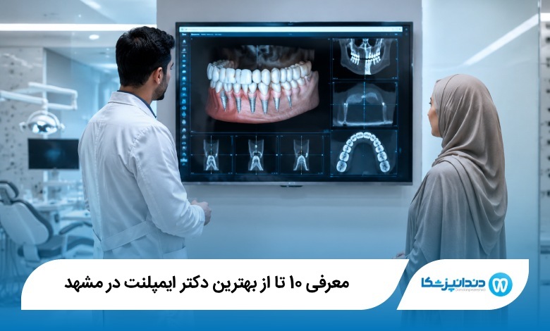 بهترین دکتر ایمپلنت در مشهد