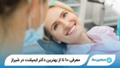 بهترین دکتر ایمپلنت در شیراز