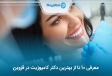 بهترین دکتر کامپوزیت در قزوین