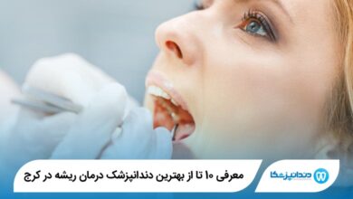 بهترین دندانپزشک درمان ریشه در کرج