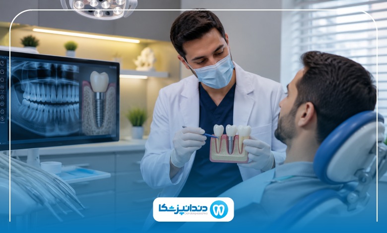 مزایای ایمپلنت دیجیتال در سعادت آباد