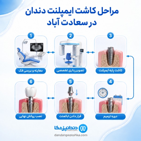 مراحل کاشت ایمپلنت دندان در سعادت آباد