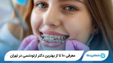 بهترین دکتر ارتودنسی در تهران