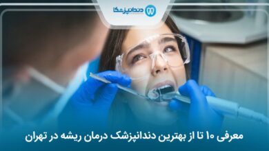 بهترین دندانپزشک درمان ریشه در تهران