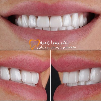 دکتر زهرا زندیه