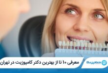 بهترین دکتر کامپوزیت در تهران