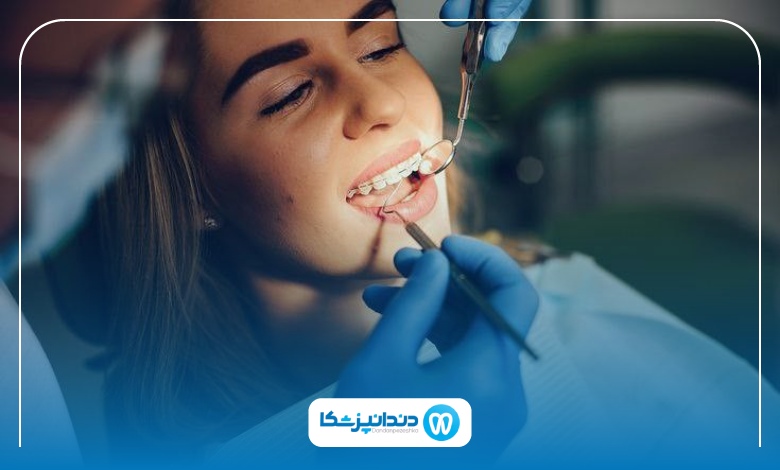 اهمیت مشاوره قبل از انجام خدمات دندانپزشکی
