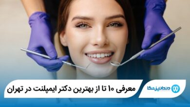 بهترین دکتر ایمپلنت در تهران