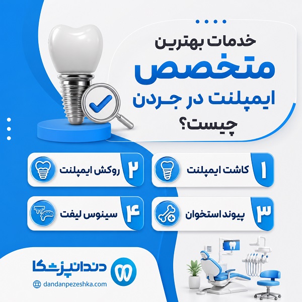 خدمات بهترین متخصص ایمپلنت در جردن چیست؟