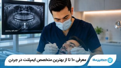 معرفی 10 تا از بهترین متخصص ایمپلنت در جردن