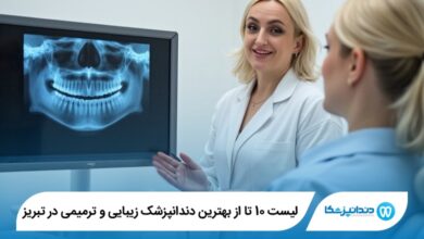 بهترین دندانپزشک زیبایی و ترمیمی در تبریز