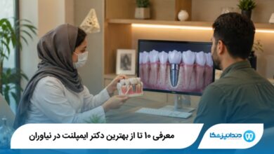 بهترین دکتر ایمپلنت در نیاوران