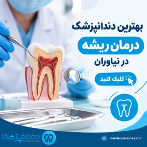 بهترین دندانپزشک درمان ریشه در نیاوران