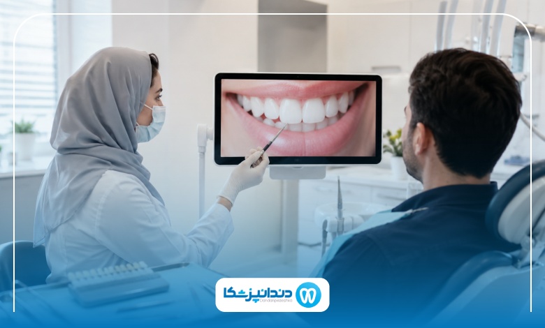 لمینت دندان برای چه کسانی مناسب است؟