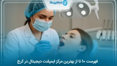 بهترین مرکز ایمپلنت دیجیتال در کرج