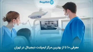 بهترین مرکز ایمپلنت دیجیتال در تهران