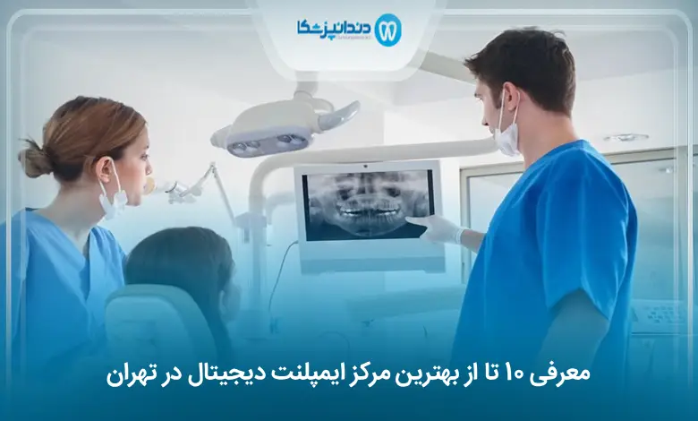 بهترین مرکز ایمپلنت دیجیتال در تهران