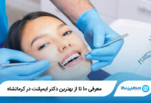 بهترین دکتر ایمپلنت در کرمانشاه
