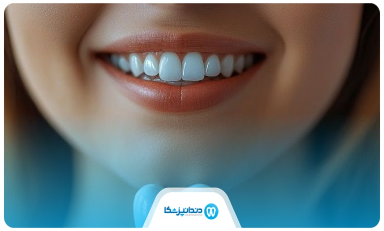 خدمات بهترین متخصص لمینت در شیراز 