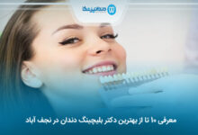 بهترین دکتر بلیچینگ دندان در نجف آباد