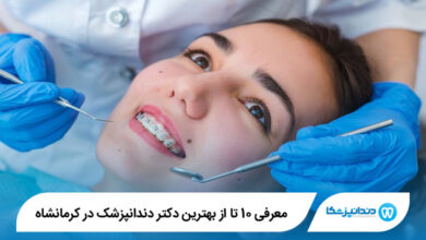 بهترین دکتر دندانپزشک در کرمانشاه