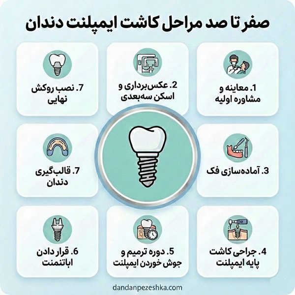 ویژگی های بهترین دکتر ایمپلنت در بابل