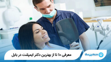 بهترین دکتر ایمپلنت در بابل