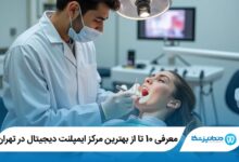 بهترین مرکز ایمپلنت دیجیتال در تهران