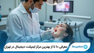 بهترین مرکز ایمپلنت دیجیتال در تهران